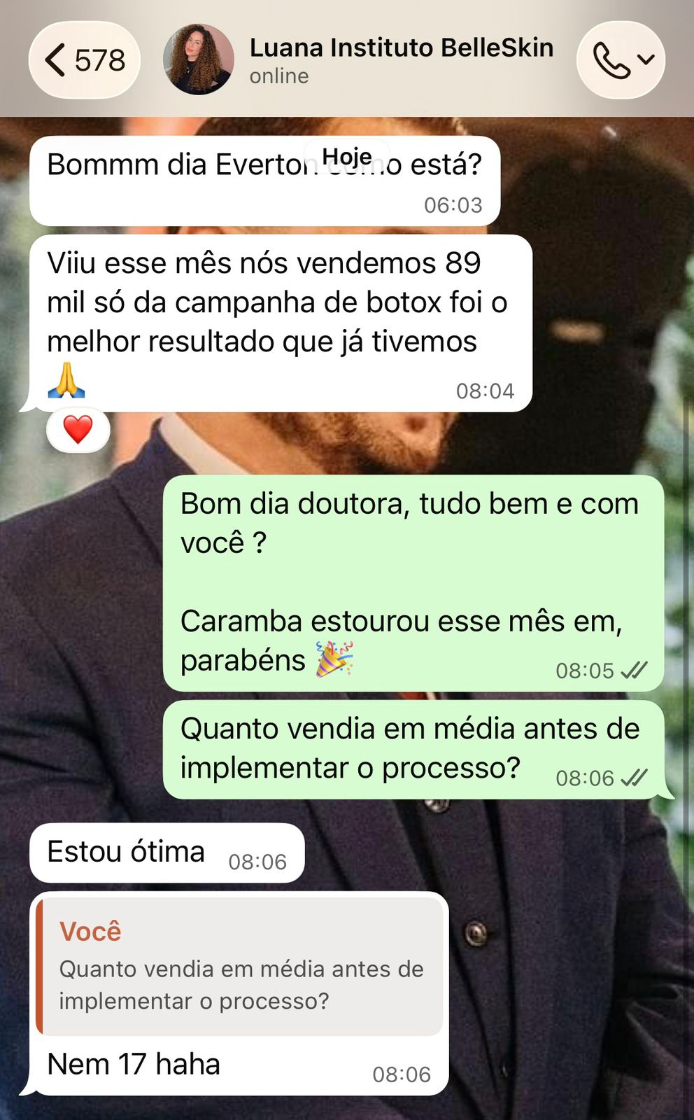 Depoimento WhatsApp — Luana — Instituto BelleSkin